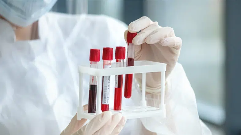 Hangi kan grubuna sahip kişiler daha zeki? En yüksek IQ'ya sahip kan grupları açıklandı!