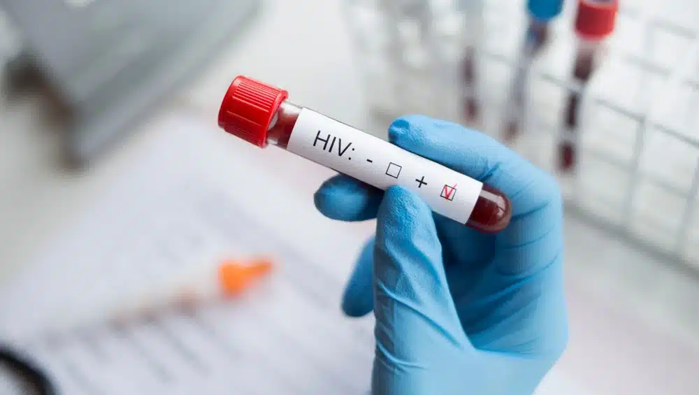 Dünyada düşüşe geçen HIV vakaları Türkiye'de artıyor.