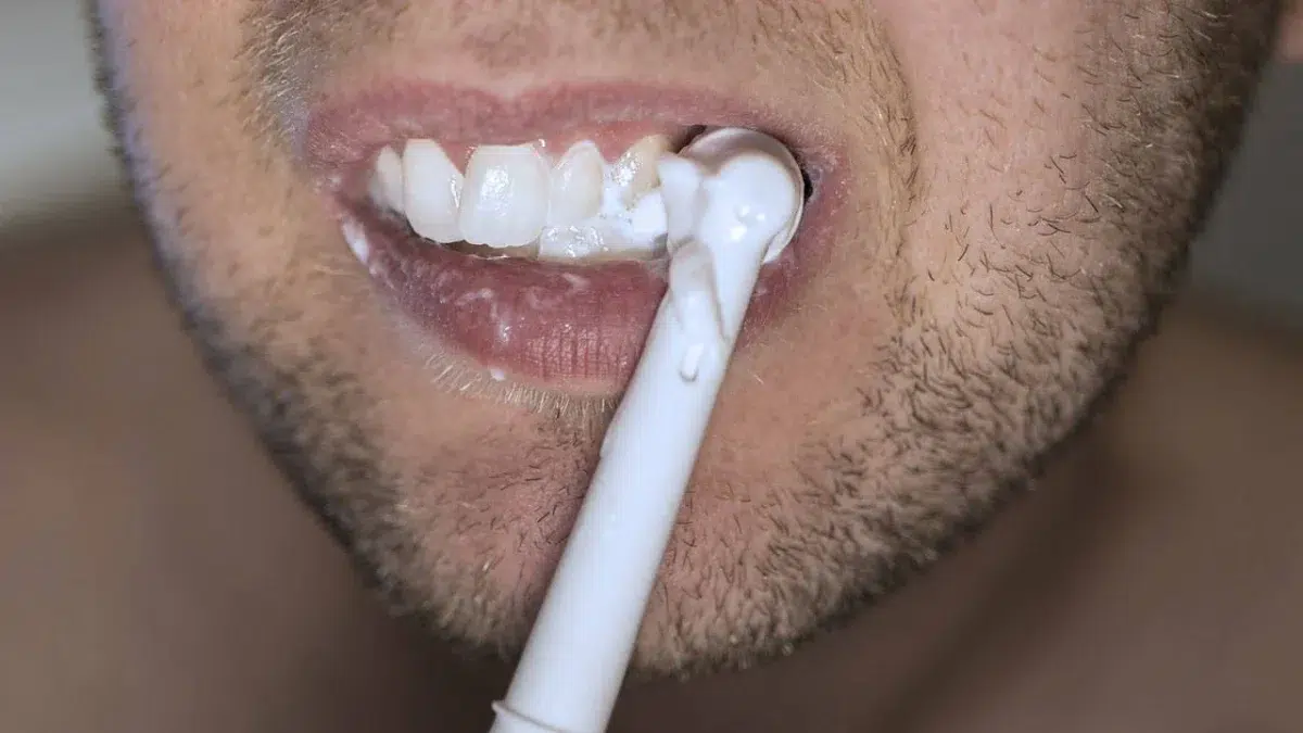 İnternetten alınan diş beyazlatma kitleri için uyarı!