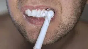 İnternetten alınan diş beyazlatma kitleri için uyarı!